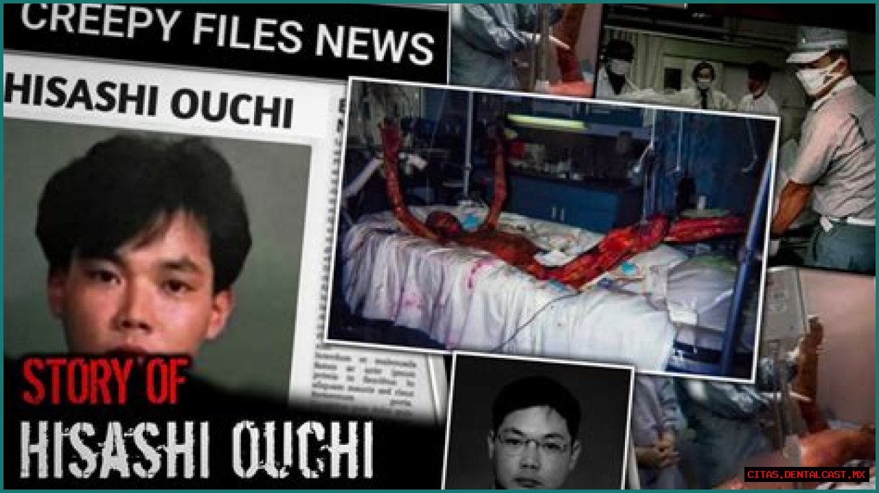Unveiling The Tragic Story Behind Hisashi Ouchi Hospital Photos